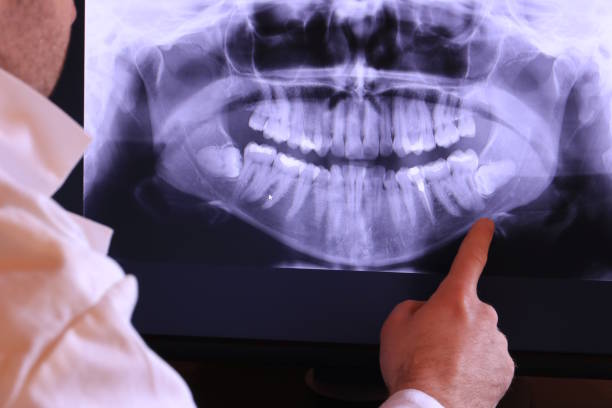 Best Emergency Dental Care for Abscessed Tooth in Albany, CA