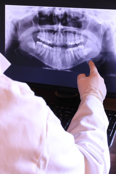Best Emergency Dental Extractions in Albany, CA